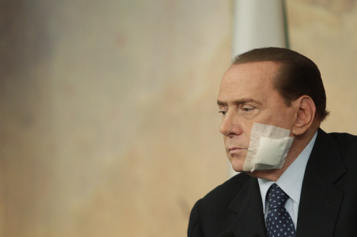 Italian Premier Silvio Berlusconi looks on during a press conference following a cabinet meeting on the justice reforms, in Rome, Thursday, March 10, 2011. Berlusconi has an adhesive bandage on his face after undergoing jaw surgery earlier this week. (AP-Yonhap News)