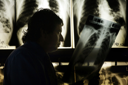 Dr. David Ashkin, a pulmonary specialist with a research interest in tuberculosis, examines a chest X-ray at A.G. Holley State Hospital in Florida. (Bloomberg)