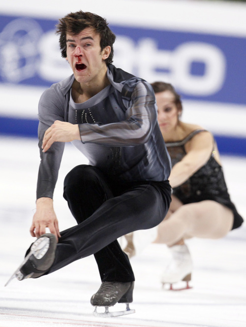 Canadian skater Eric Radford is seen with bleeding nose as he and Meagan Duhamel perform their short program at the ISU Figure skating World championships in Moscow, Russia, Wednesday, April 27, 2011. (AP-Yonhap News)