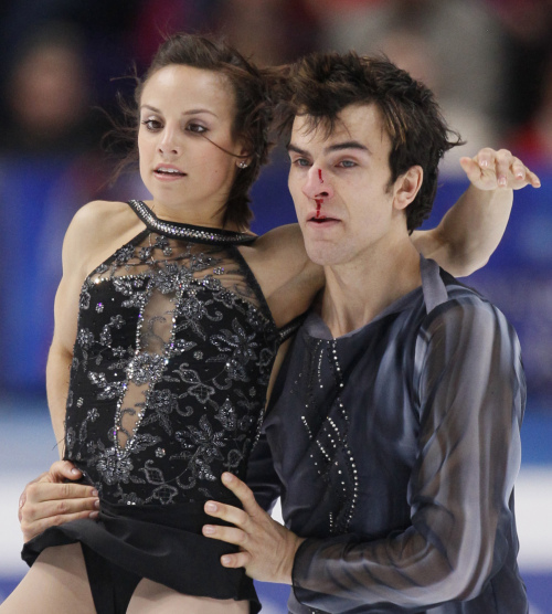 Canadian skater Eric Radford, with a bloodied nose, and Meagan Duhamel perform their short program at the ISU Figure skating World championships in Moscow, Russia, Wednesday, April 27, 2011. (AP-Yonhap News)