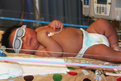This photo provided by Good Shepherd Medical Center Marketing Department shows JaMichael Brown Monday, July 11, 2011, in the hospital's neonatal care unit in Longview, Texas. (AP-Yonhap News)