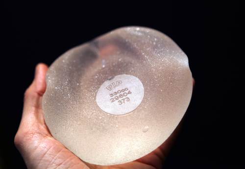A picture taken on December 21, 2011 in Nice, southeastern France shows a breast implant produced by PIP (Poly Implant Prothese) company after a surgical operation. Up to 30,000 French women and perhaps tens of thousands more around the world may need to have defective breast implants removed after several suspicious cancer cases, officials said on December 20, 2011. (AFP-Yonhap News)
