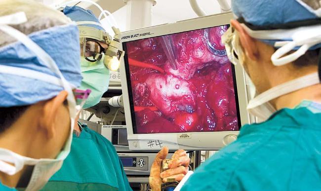 A monitor in the operating room shows a mesothelioma tumor (top right) just above the pulmonary artery as thoracicsurgeon Joseph S. Friedberg, M.D., center, operates to remove the tumor from the chest of a patient at PennPresbyterian Medical Center, June 19. (David M. Warren/Philadelphia Inquirer/MCT)