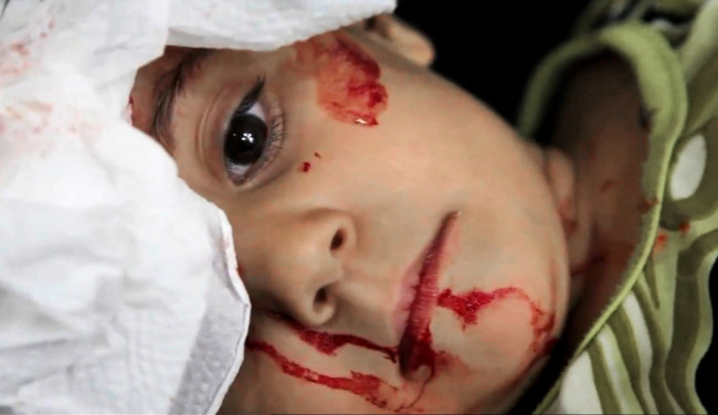 This image taken from video filmed by an independent cameraman and made available on Monday shows a wounded Syrian child at the Dar al-Shifa hospital, in Aleppo, Syria. (AP-Yonhap News)