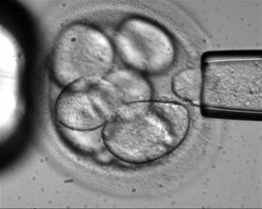 A single cell is removed from a human embryo in a lab. (AP)