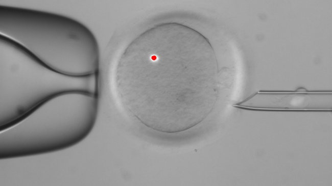 A faint white blotch in the tube at right is DNA that has been removed from a human egg (center). The red dot is from a laser used in the procedure. Scientists have successfully transplanted DNA between human eggs and grown them into early embryos. Someday that technique that may let children avoid inheriting certain diseases ― and give them genes from another woman besides Mom. (AP-Yonhap News)