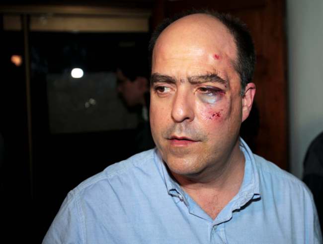 Opposition lawmaker Julio Borges arrives with a bruised face to his political party’s headquarters before speaking to the press in Caracas on Tuesday. (AP-Yonhap News)