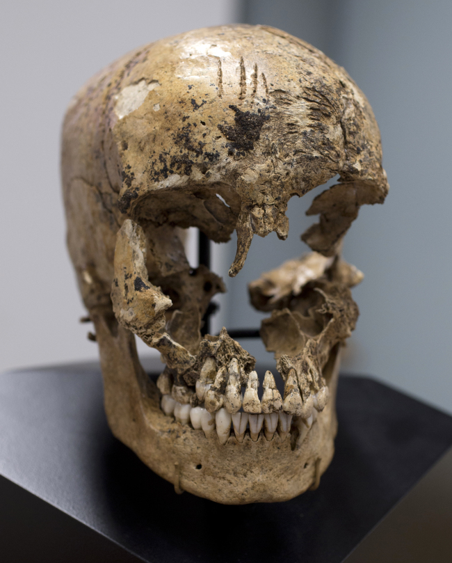 Strike marks on the skull (bottom) and a facial reconstruction (top) of “Jane of Jamestown” are seen during a news conference at the Smithsonian’s National Museum of Natural History in Washington on Wednesday. (AP-Yonhap News)