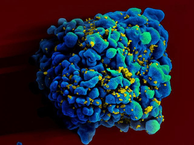 This electron microscope image shows an H9 T-cell infected with the human immunodeficiency virus. ( AP-Yonhap)
