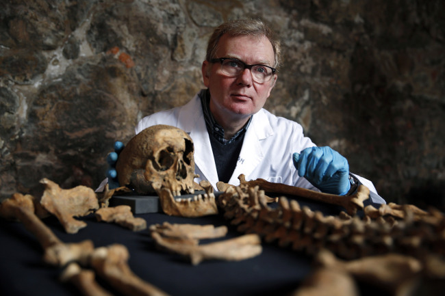 Don Walker, a human osteologist with the Museum of London, holds the skull of one of the skeletons found by construction workers under central London’s Charterhouse Square on Wednesday. (AP-Yonhap)