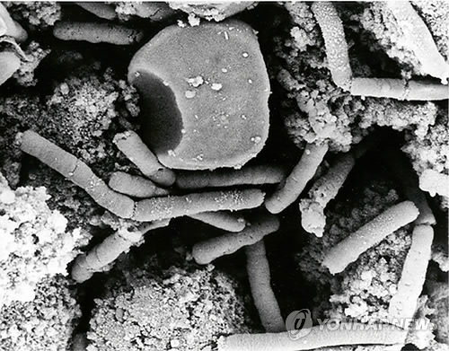 미국 국방부가 제공한 탄저균의 전자현미경 사진 (AP=연합뉴스/자료사진)