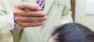 Scalp acupuncture is performed to increase scalp blood circulation at Thebom Korea Medicine Clinic Bundang Branch. (Thebom Korea Medicine Clinic)