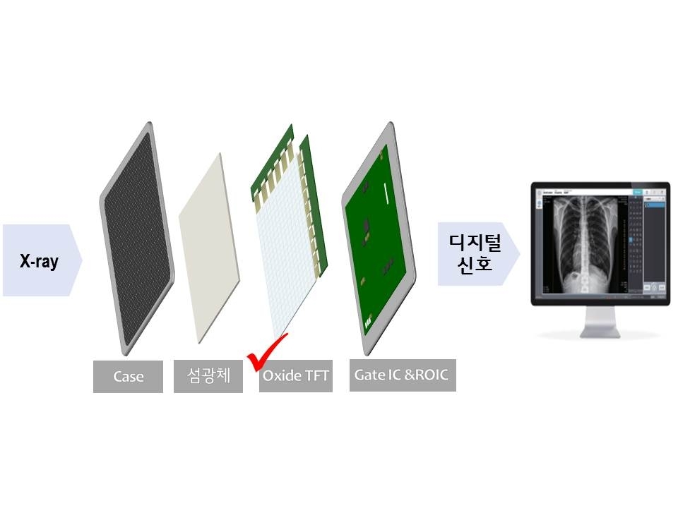 This image provided by LG Display Co. on Tuesday, shows the concept of a digital X-ray detector using oxide-based thin film transistors. (LG Display Co.)