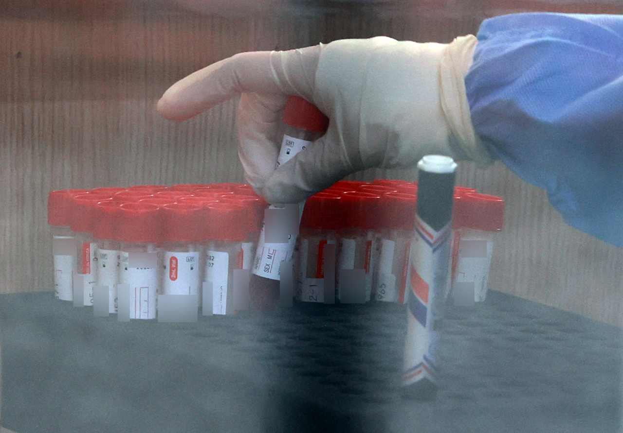 An official places a sample for coronavirus at a testing clinic at Seoul Station Square on Wednesday. (Yonhap)