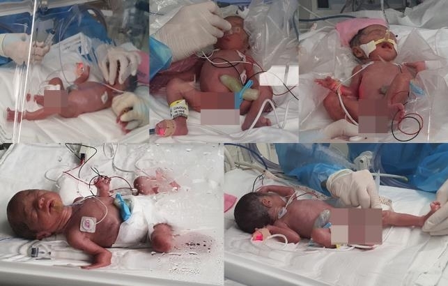 Photos of the quintuplets born at the Seoul National University Hospital on late Thursday night. (Seoul National University Hospital)