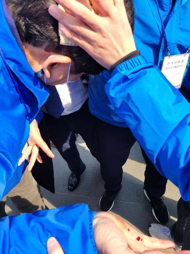 The image shows Rep. Song Young-gil's head after being hit by a hammer during a campaign rally held in Seodaemun-gu, western Seoul, on Monday. (Democratic Party of Korea)