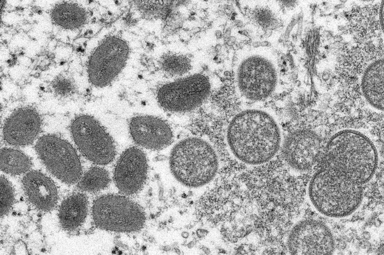 This 2003 electron microscope image made available by the US CDC shows mature, oval-shaped monkeypox virions (left), and spherical immature virions (right), obtained from a sample of human skin associated with the 2003 prairie dog outbreak. (Yonhap-AP)