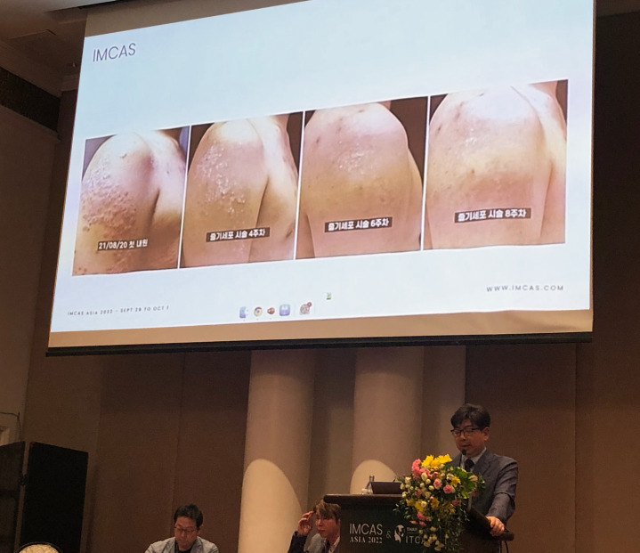 Professor Park Eun-soo presents research results of regenerative skin stem cell therapy at the IMCAS, in Bangkok, Oct. 1. (Miracell)