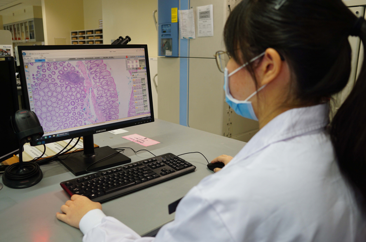 A pathologist examines a whole slide image of a tissue specimen. (Singapore General Hospital)