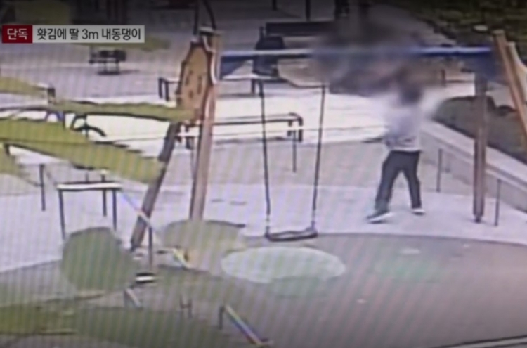Child hurt after angry dad pushes the swing too hard