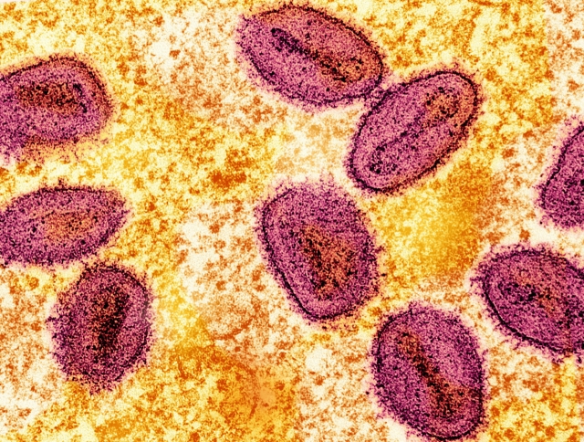 An undated colorized transmission electron micrograph of mpox virus particles (pink) found within an infected cell (yellow), cultured in the laboratory, captured at the National Institute of Allergy and Infectious Diseases and Integrated Research Facility in Fort Detrick, Maryland. (NIAID)