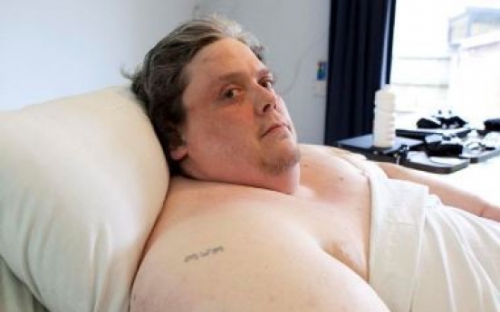 World’s fattest man starts dieting