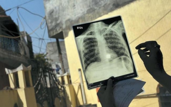 India wages hi-tech war on ancient scourge: tuberculosis