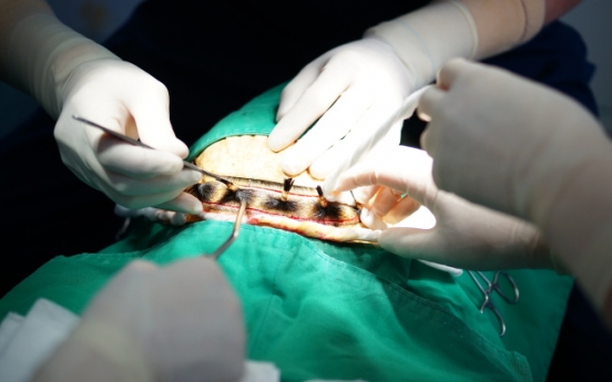 New hair transplant device developed to improve success rate