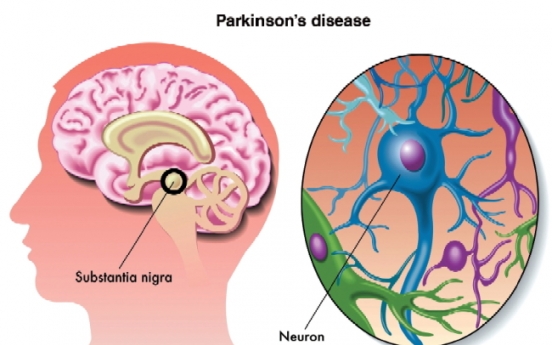 Living with Parkinson’s