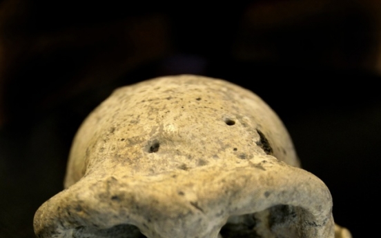 1.8M-year-old skull gives glimpse of our evolution