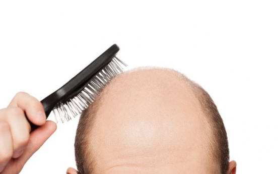 More men treated for hair loss