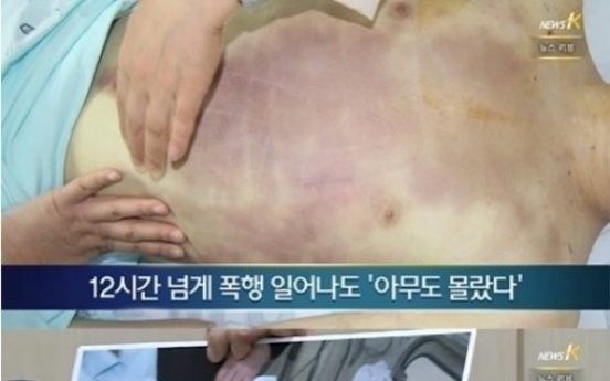 28사단 윤일병 사망사건, 군 수뇌부 문책 거론 관련 청와대 입장은...