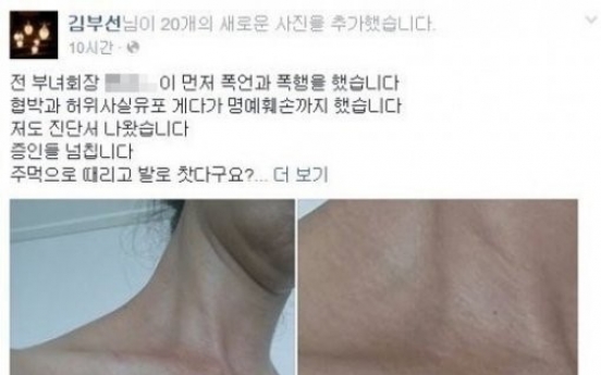 김부선, 폭행 혐의 부인 “전 부녀회장이 먼저 폭행” 멍든 사진 공개