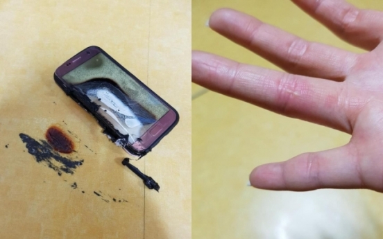 Alleged Samsung Galaxy S7 explosion causes severe burns