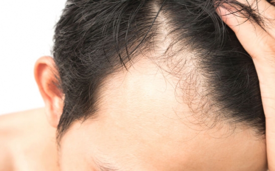 Korean scientists develop potential drug candidate for hair loss