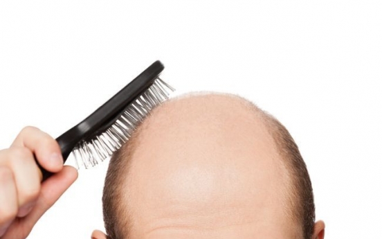 Human rights agency defends man ‘discriminated’ against for hair loss