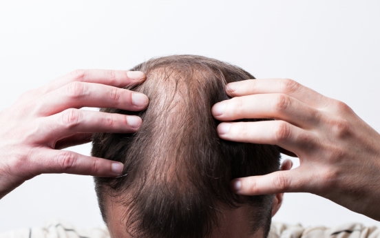 Municipalities offer subsidies for hair loss treatment