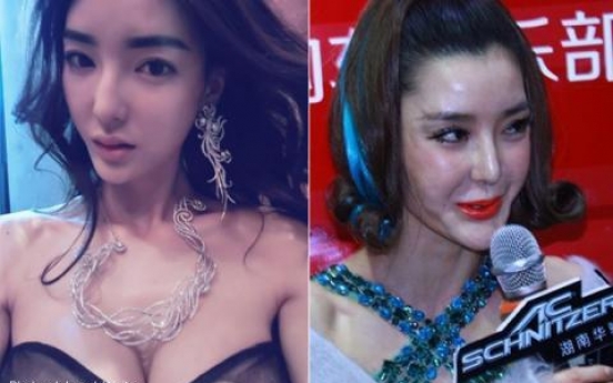 중국 톱 모델 성형 '약발' 끝난 사진, 팬들 충격