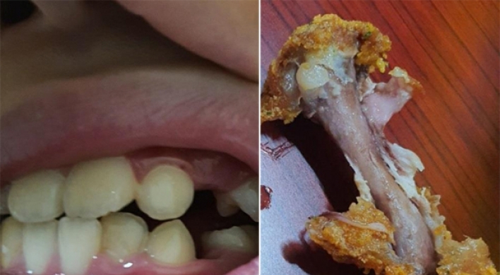 12-year-old boy injured from a metal screw found in a fried chicken wing