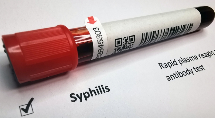 Syphilis cases in S. Korea surge amid stricter reporting rules