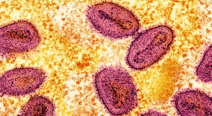 Malaysia reports new mpox case of clade 2 variant