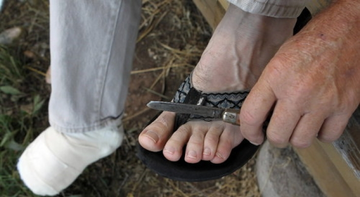 Logger cuts off own toes after foot is pinned