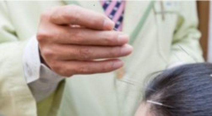 [Weekender] Lengths people go to stop hair loss