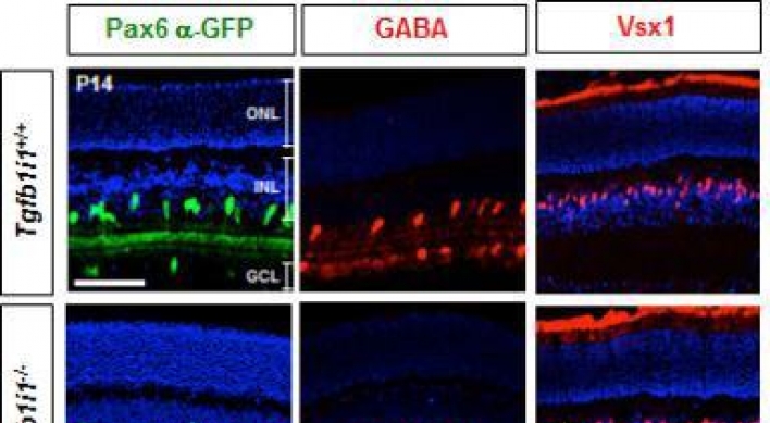 Scientists discover retina cell related to light sensitivity