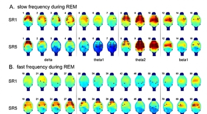Scientists discover REM sleep's role in memory development