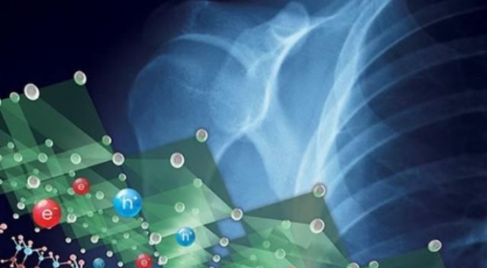 Samsung develops X-ray machine technology that sharply cuts radiation exposure