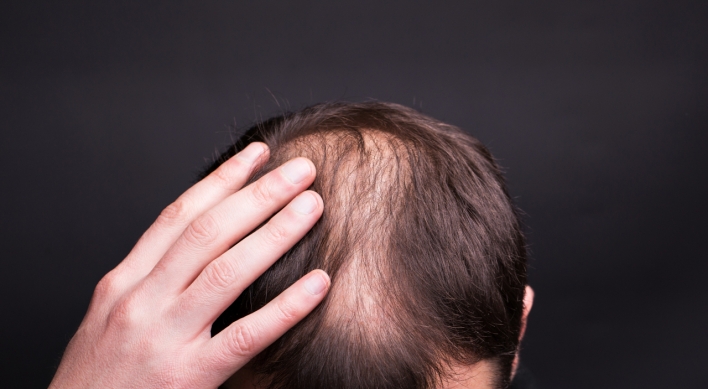 Alopecia expert recommends washing hair less to lose less