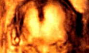 4개월 된 태아의 미소에 낙태논란이?