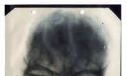 히틀러 얼굴 엑스레이 살펴보니…“이게 숨겨진 보물?”