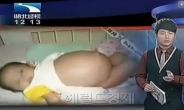 7개월된 아기 뱃속에서 ‘기생 태아’ 발견…충격